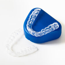 Benefits of Choosing Clear Aligners for Orthodontic Treatment