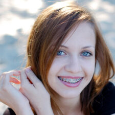 At What Age Should Kids Get Braces in Dublin, CA? A Parent’s Guide